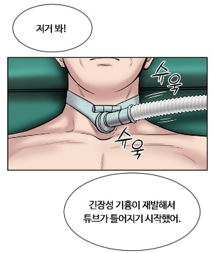 Webtoon_tracheal_deviation.jpg