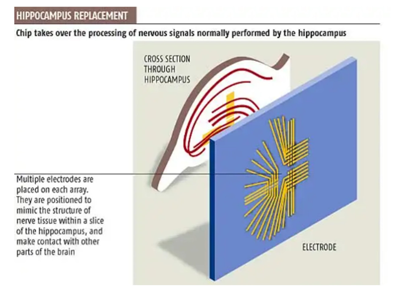 Rat memory prosthesis1.jpg