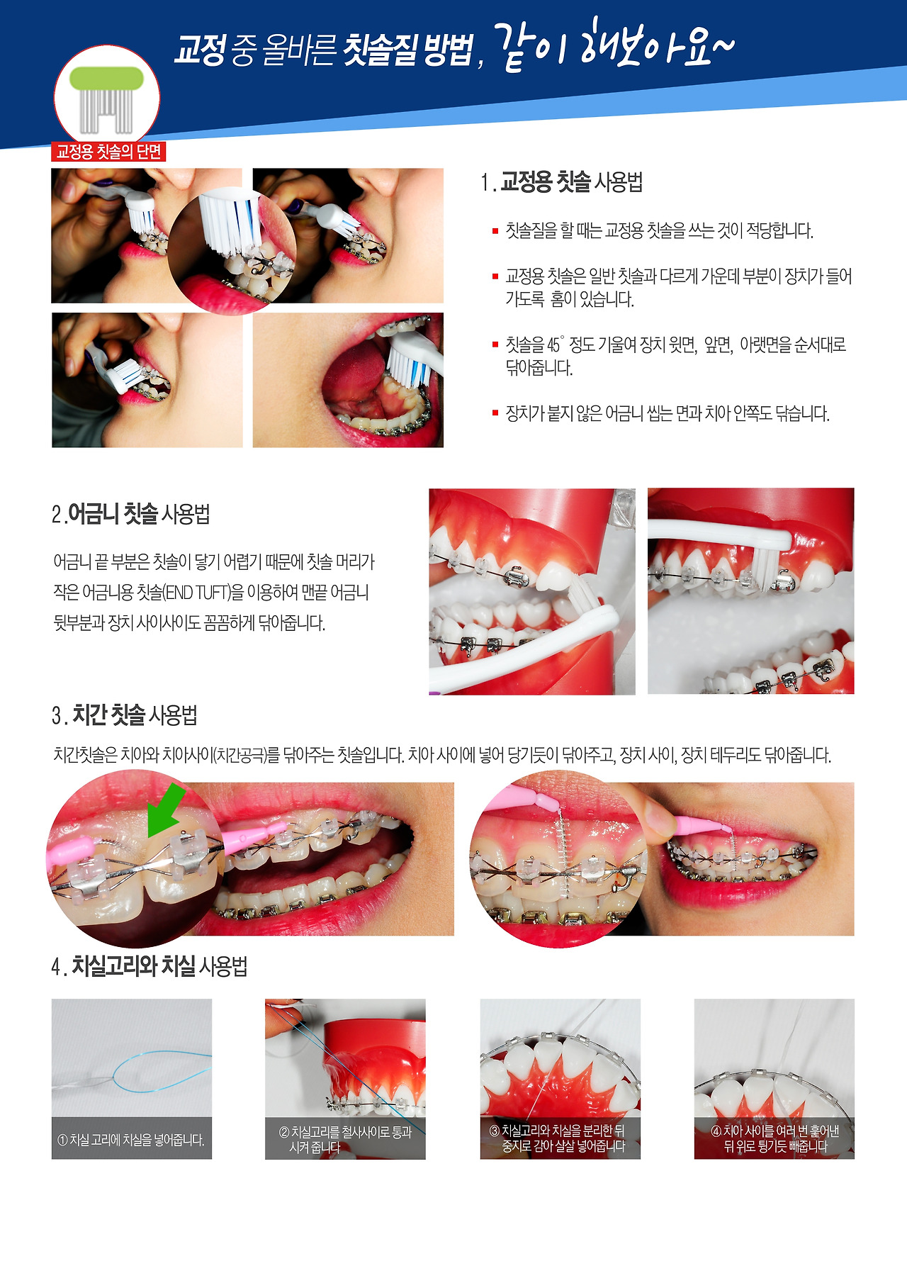 50.교정할때치아관리.jpg