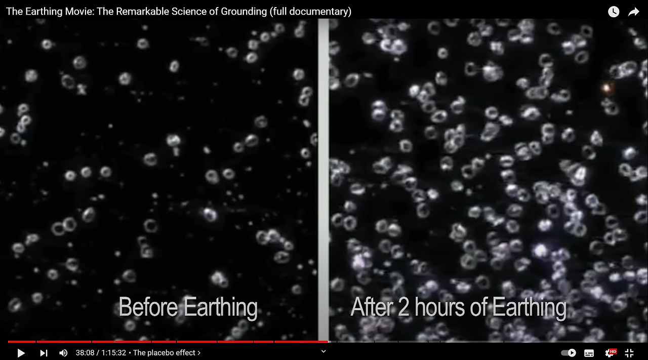 적혈구 사진.jpg