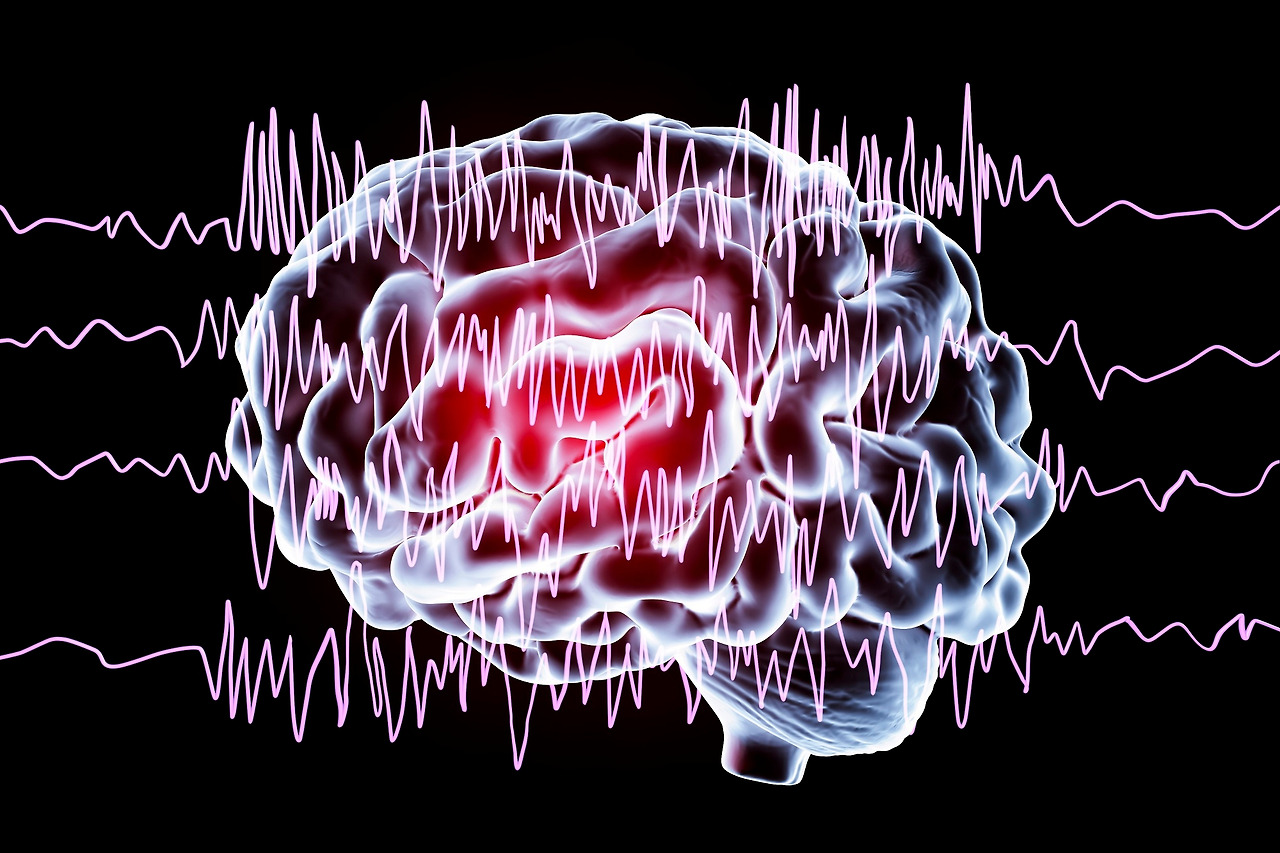 Brain.Brain_.Waves_.Epilepsy_G_956351618.jpg