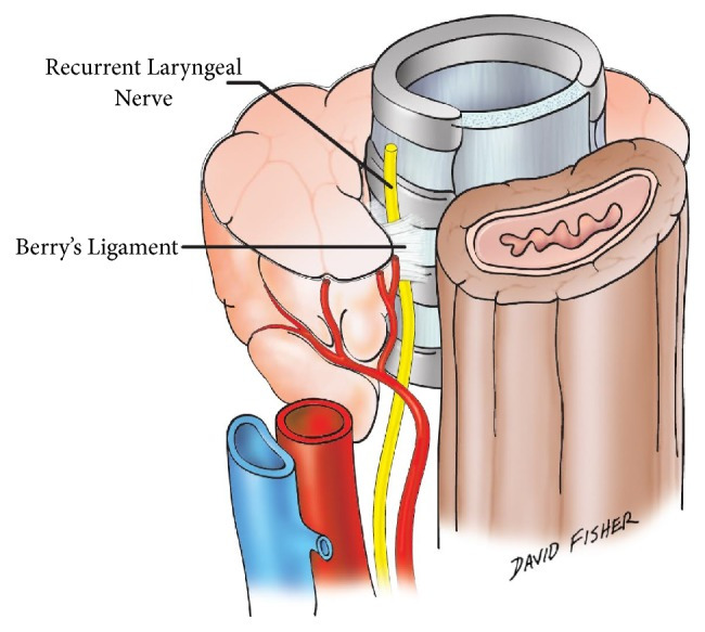 ligament of berry BMRI2017-4357591.001.jpg