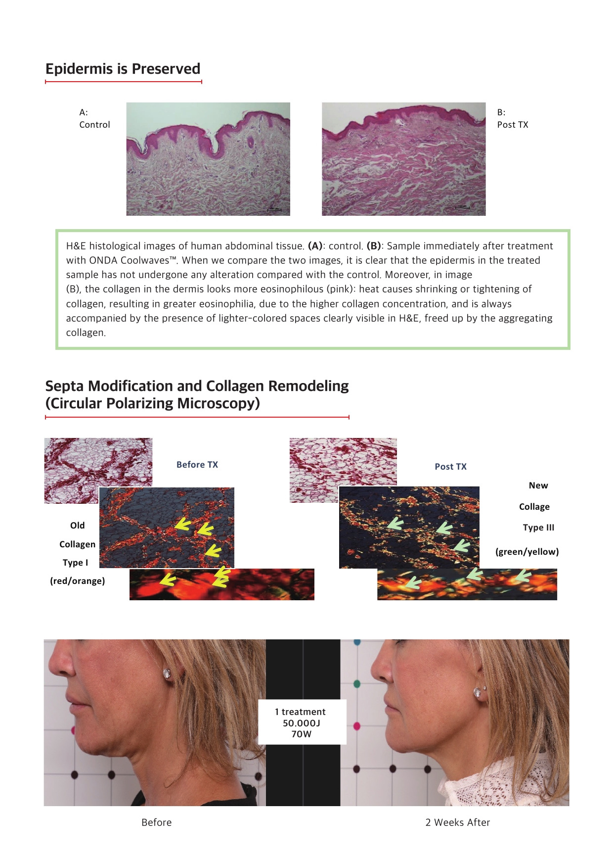 ONDA 카다로그_12p-8-9.jpg