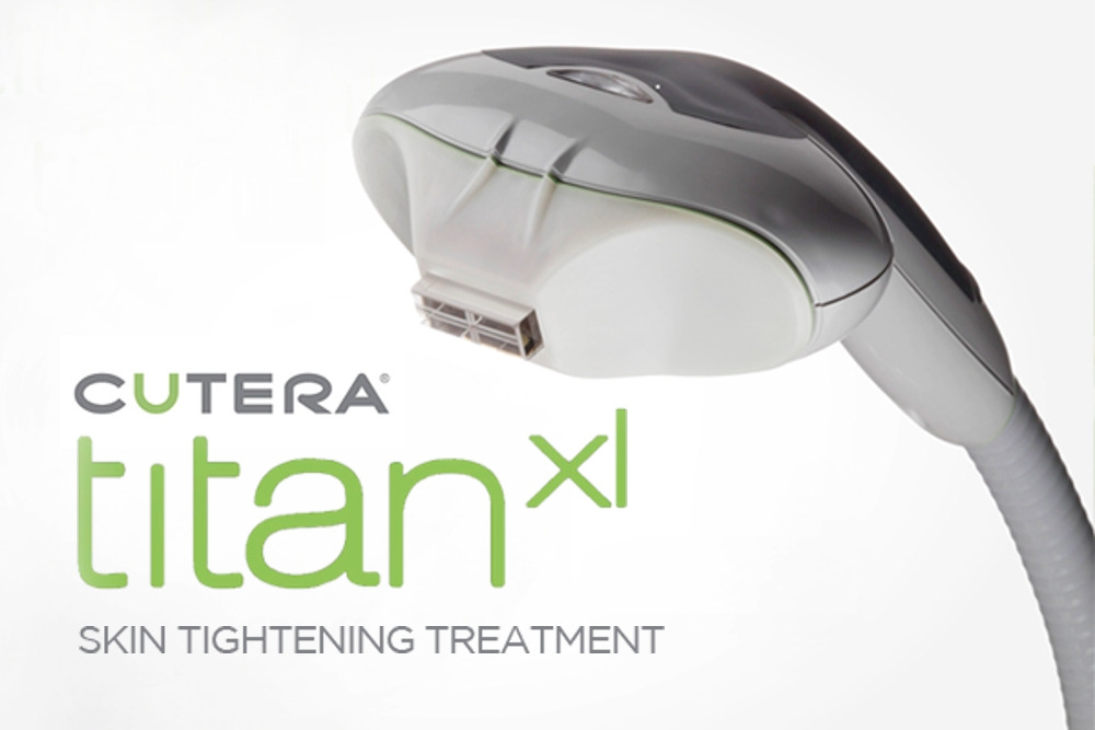 cutera-titan-skin-tightening.jpg