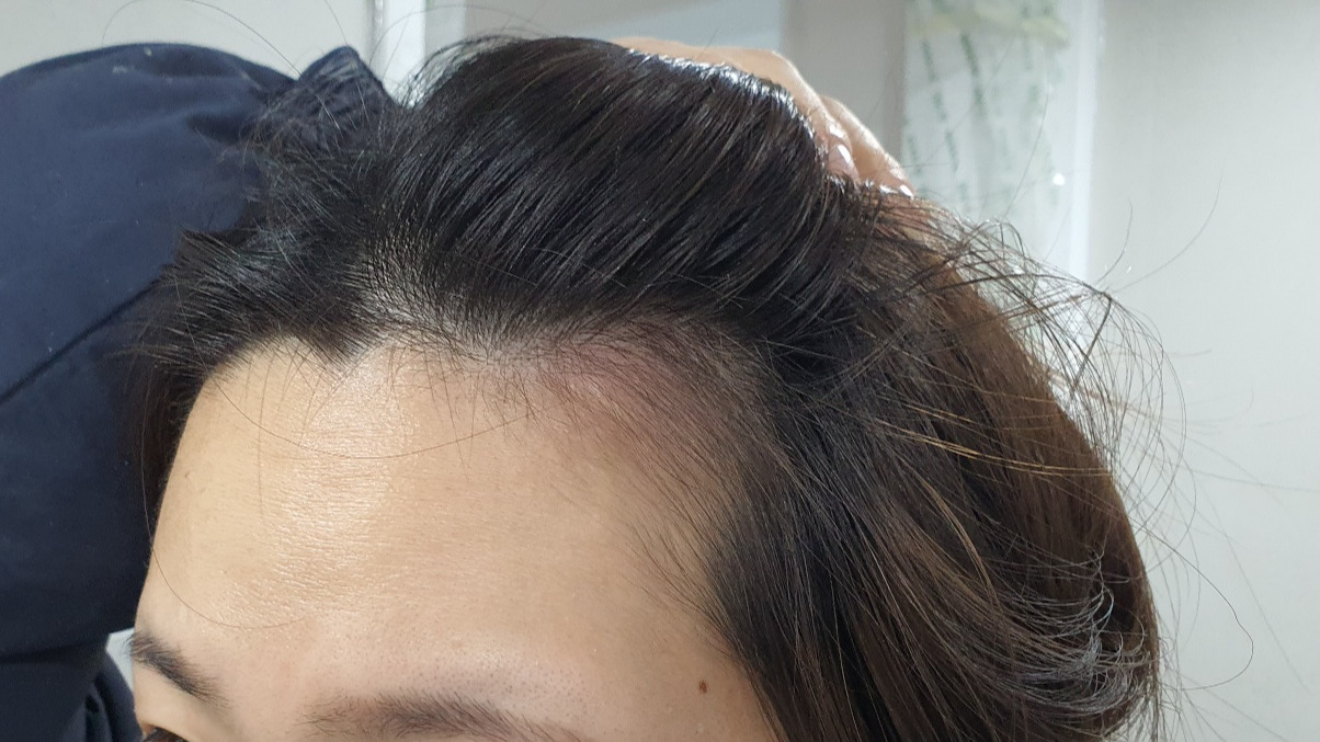 2024_02_13 10_41_30 4 파티션 설치.jpg