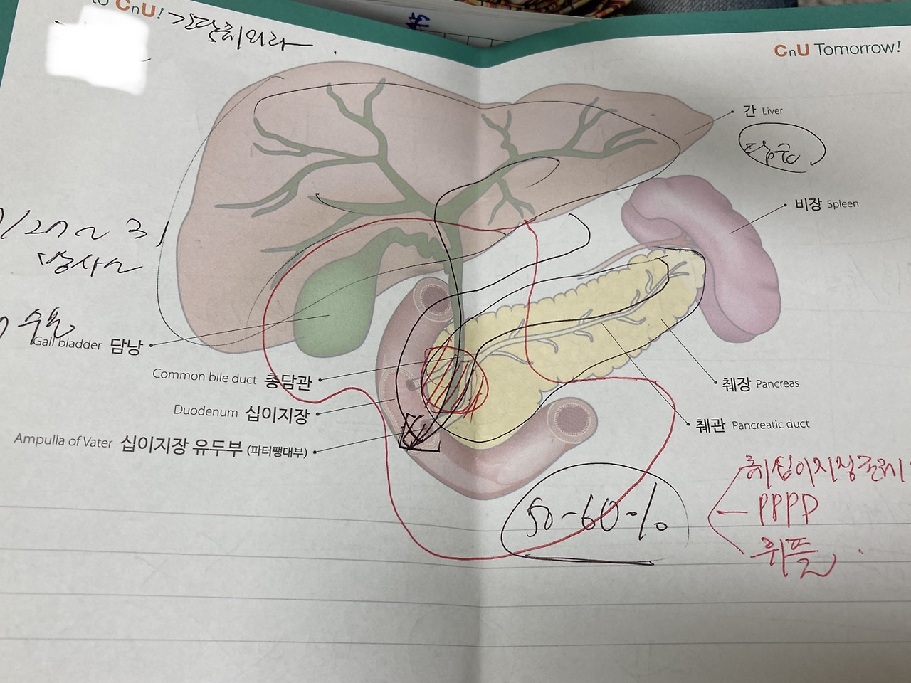 휘플씨 수술 설명 2.jpg