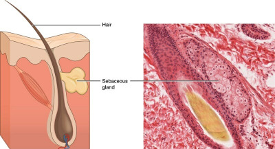 Sebaceous-Glands.jpg