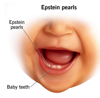 epstein-pearls.jpg