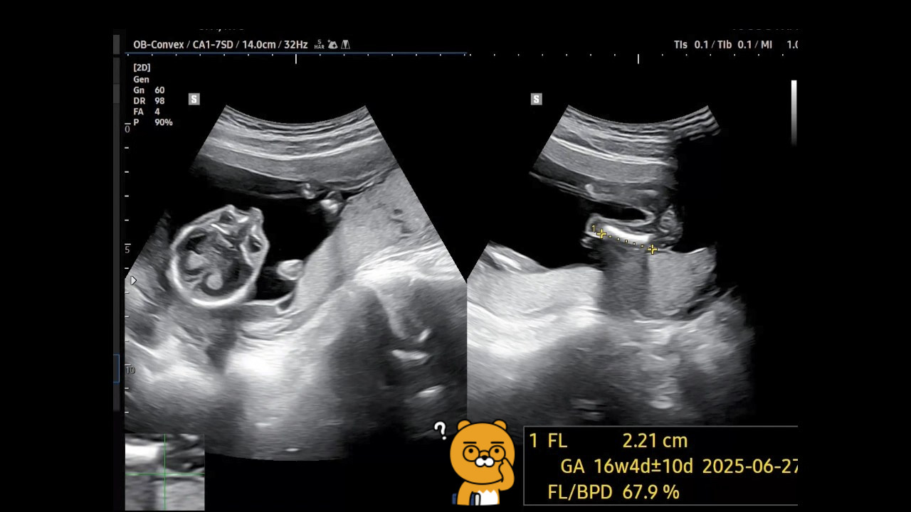 18주 차 동영상.mp4_snapshot_00.21_[2025.02.02_16.26.26].jpg