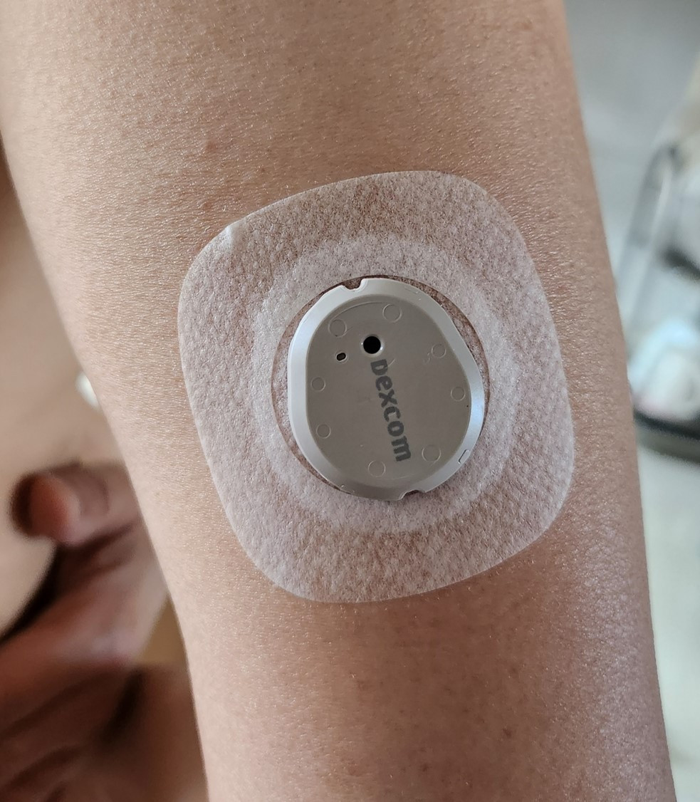 상완 부착 모습.jpg