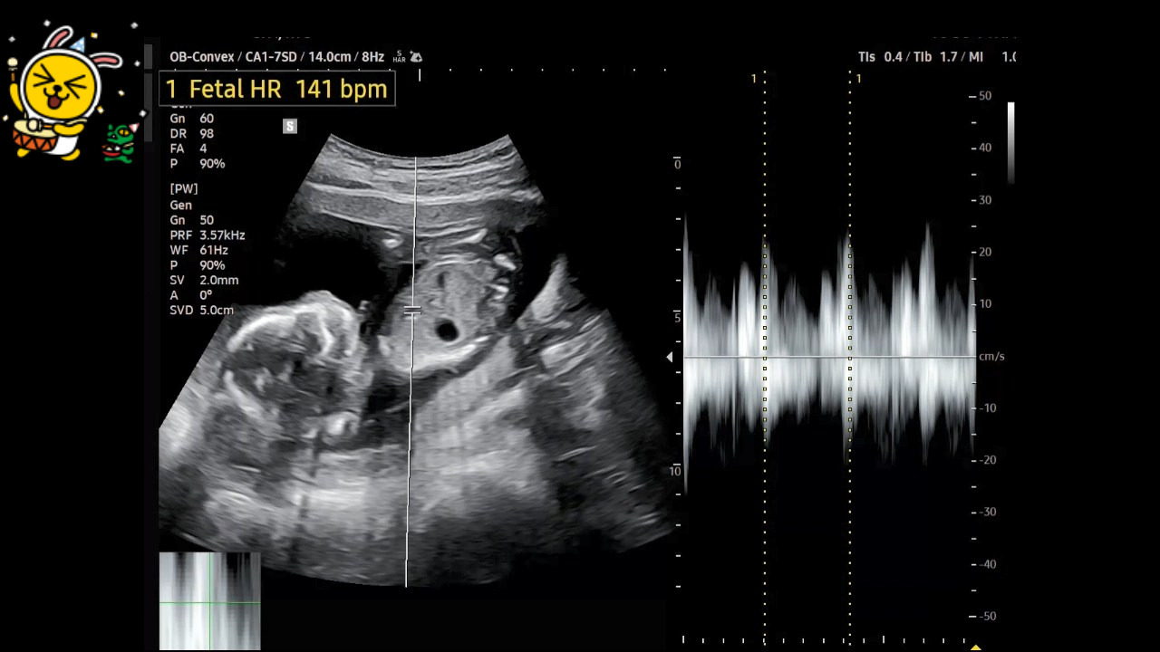 18주 차 동영상.mp4_snapshot_00.11_[2025.02.02_16.25.36].jpg