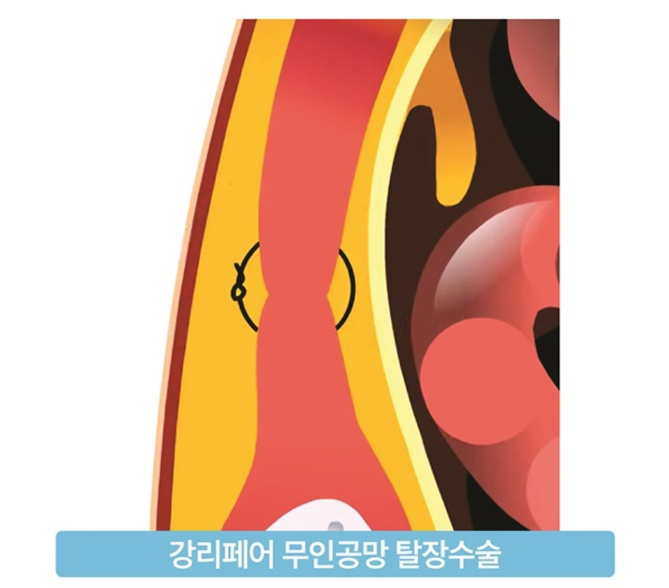 화면 캡처 2025-03-18 153037.jpg