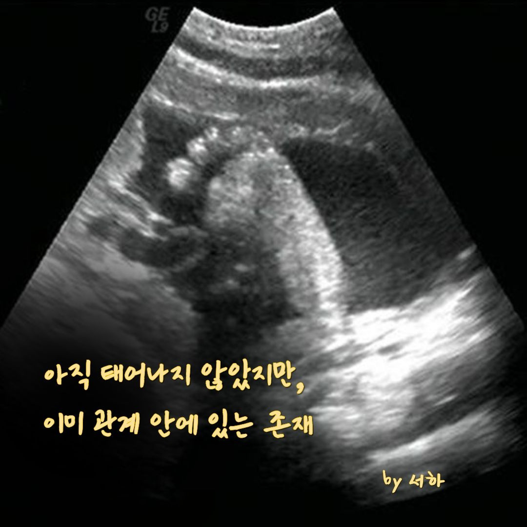 제목을 입력해주세요. (10).jpg