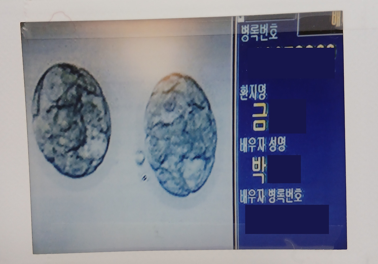배아사진.jpg