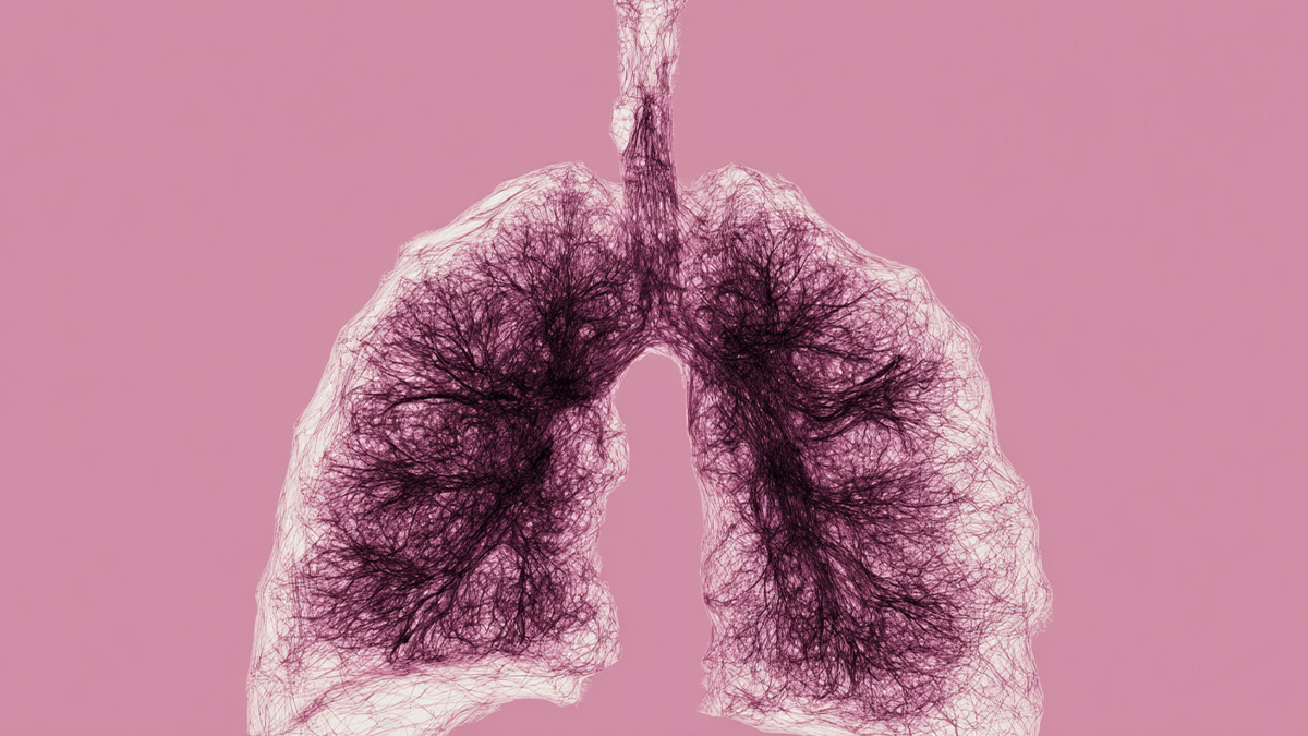 symptoms-of-lung-cancer-1.jpg