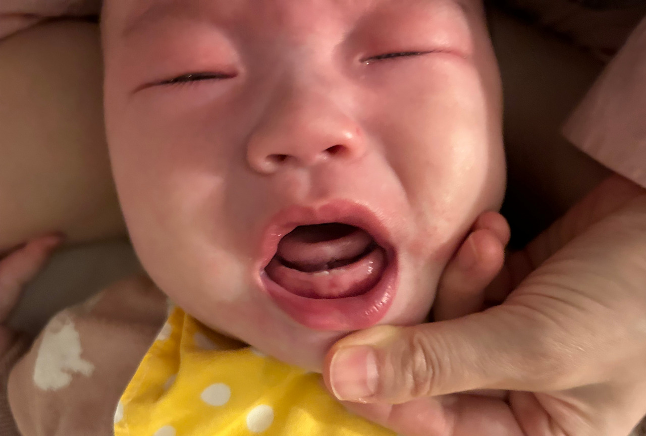 6개월 첫앞니.jpg