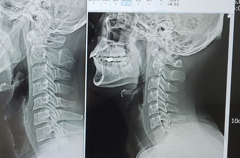 카지노 쿠폰