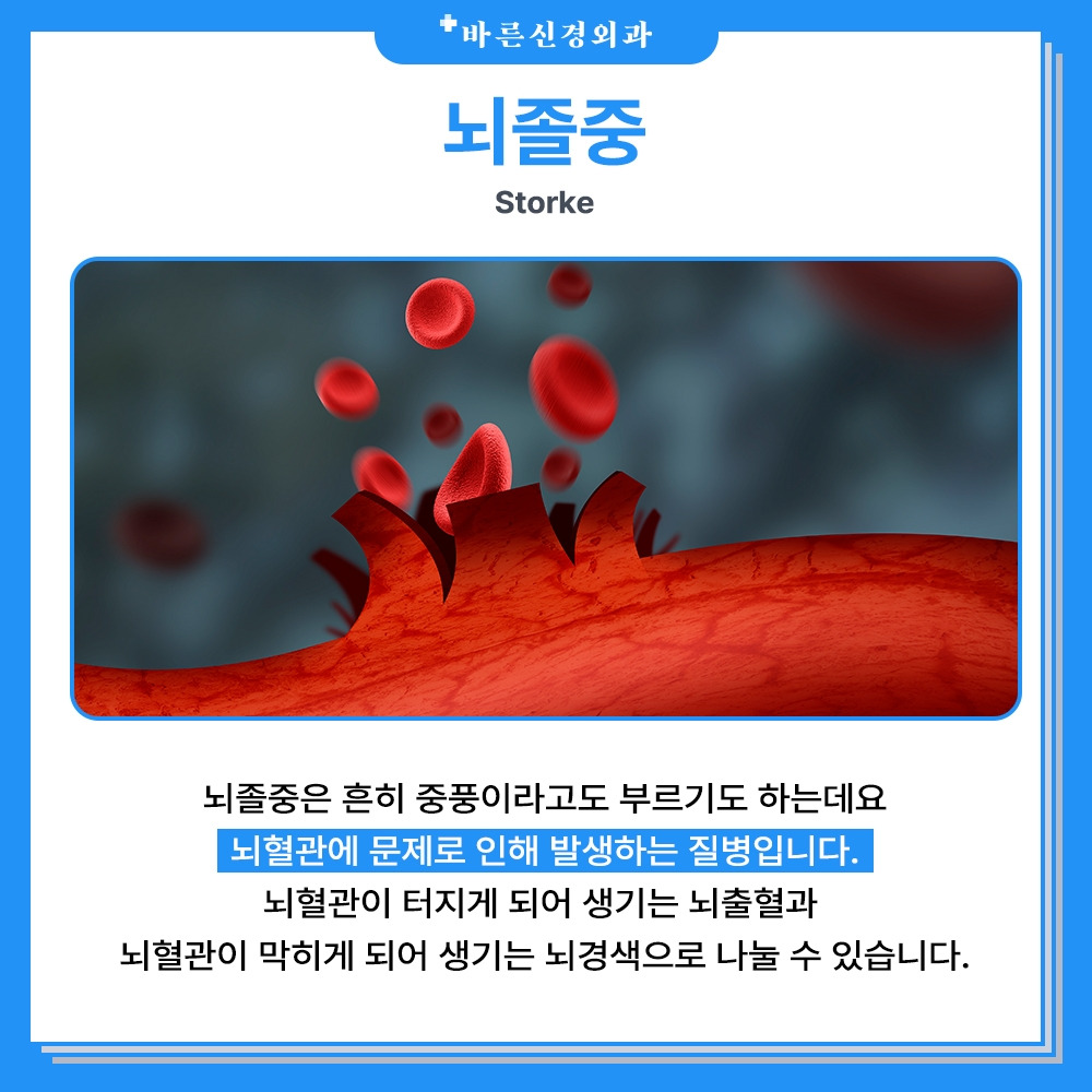 뇌졸중.jpg