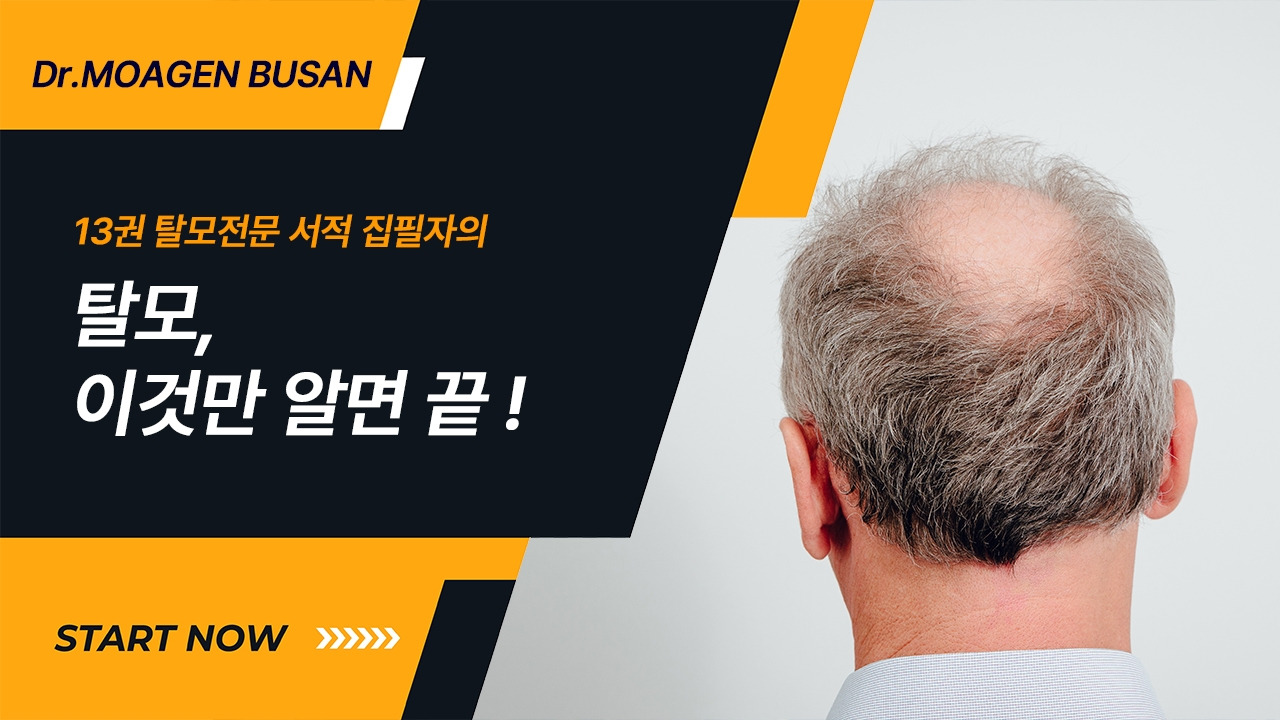 19-탈모, 이것만 알면 끝.jpg