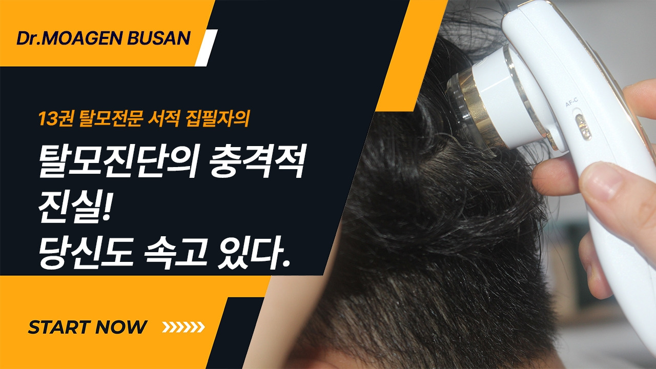 탈모진단의충격적진실.jpg