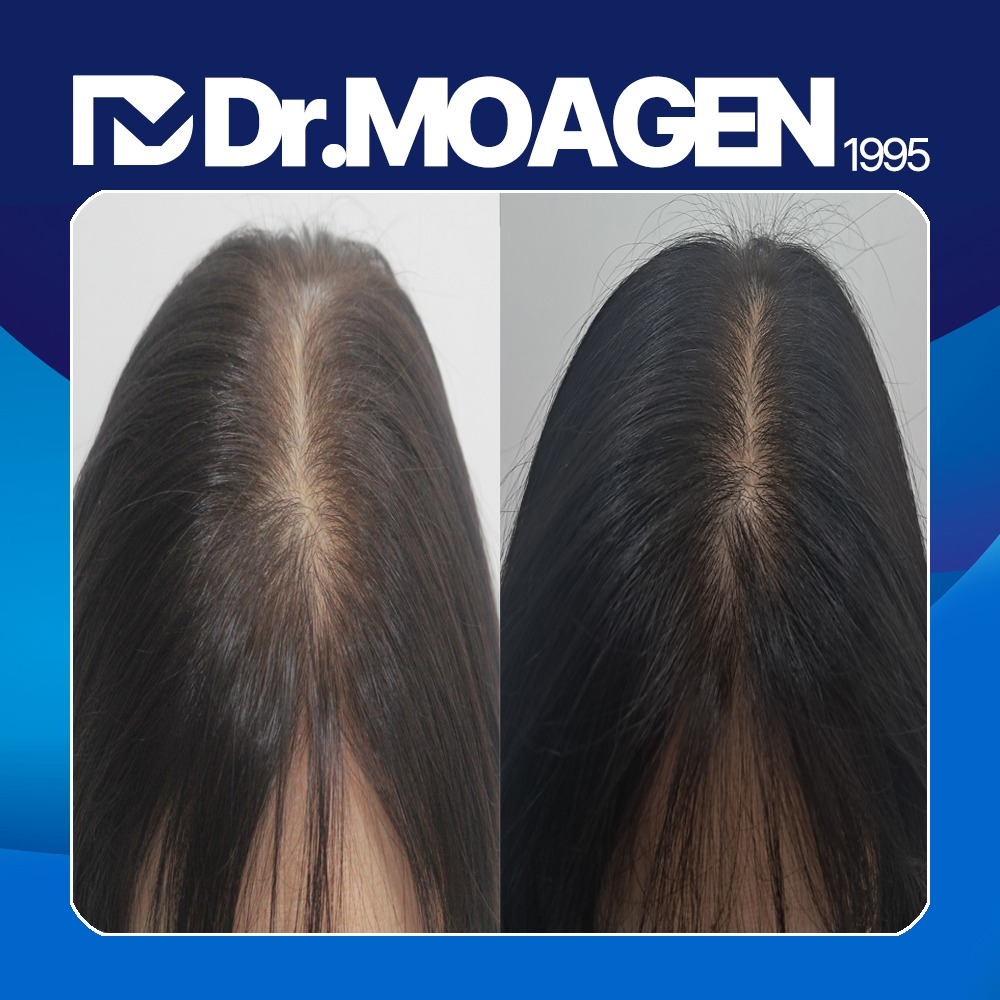 동래 두피클리닉.jpg