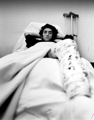 병상의 장이머우.jpg