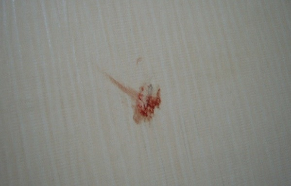 핏자국.jpg