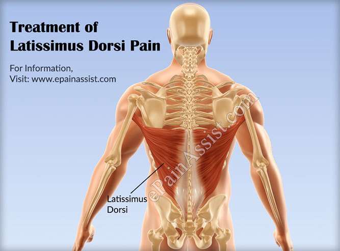 treatment-of-latissimus-dorsi-pain.jpg