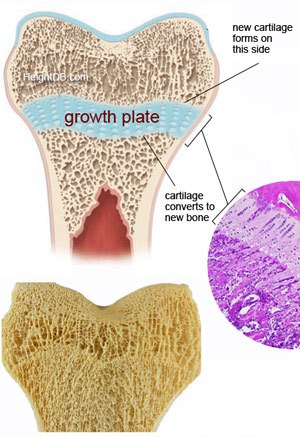 growth-plates-taller.jpg