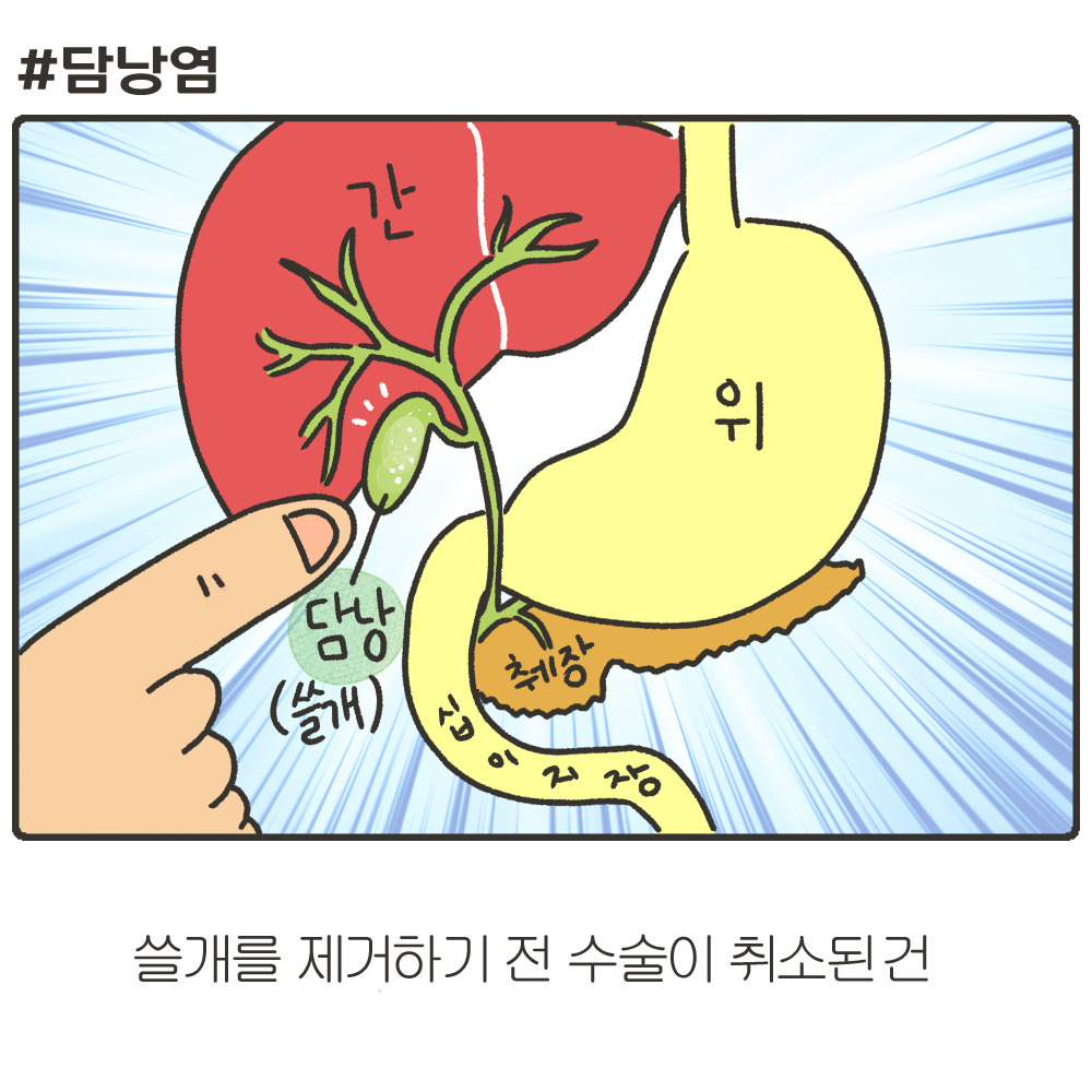 출산 후 담낭염