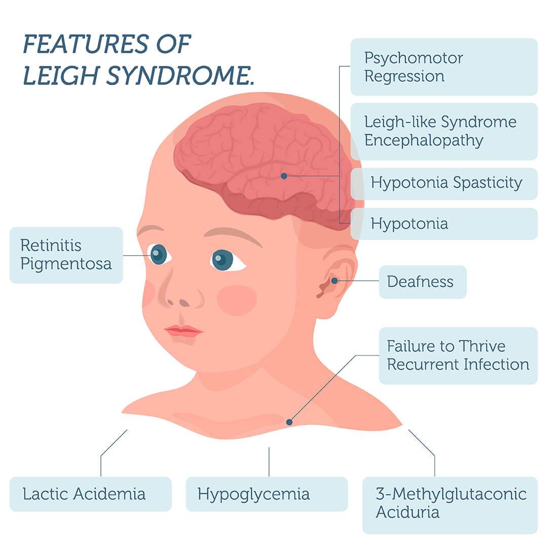 leigh_syndrome3.jpg
