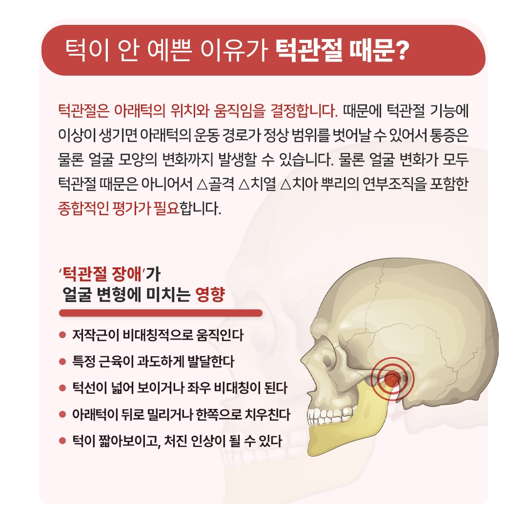 턱관절장애_02.jpg