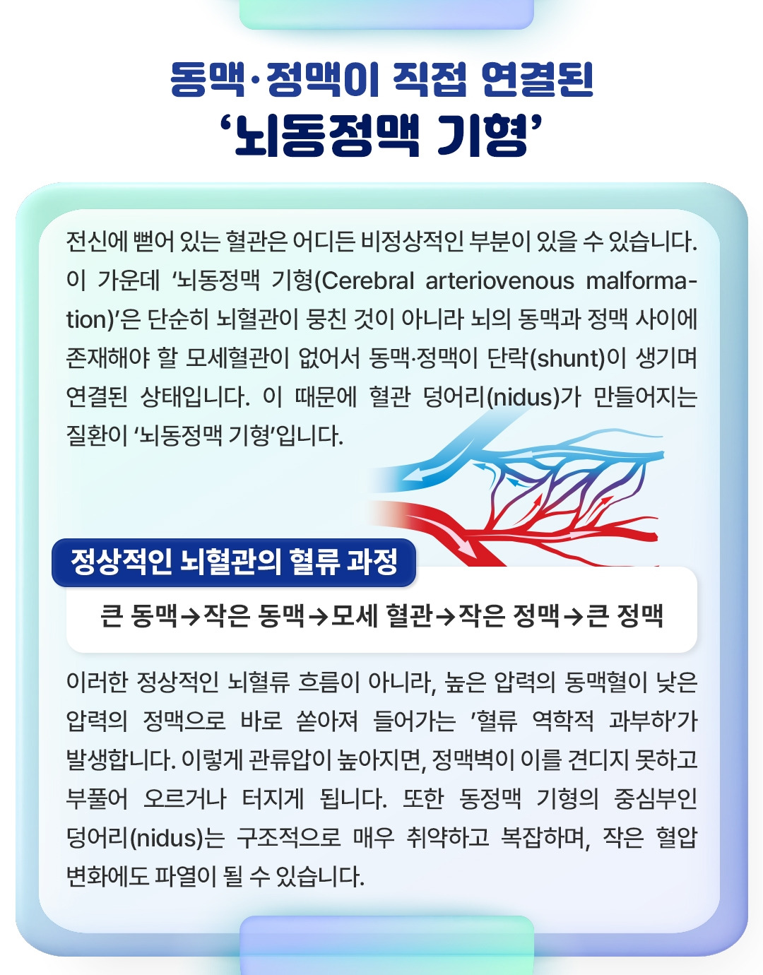 뇌동정맥 기형_02.jpg