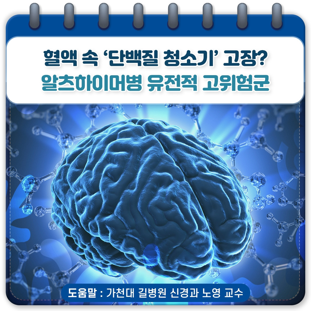 알츠하이머_01.jpg