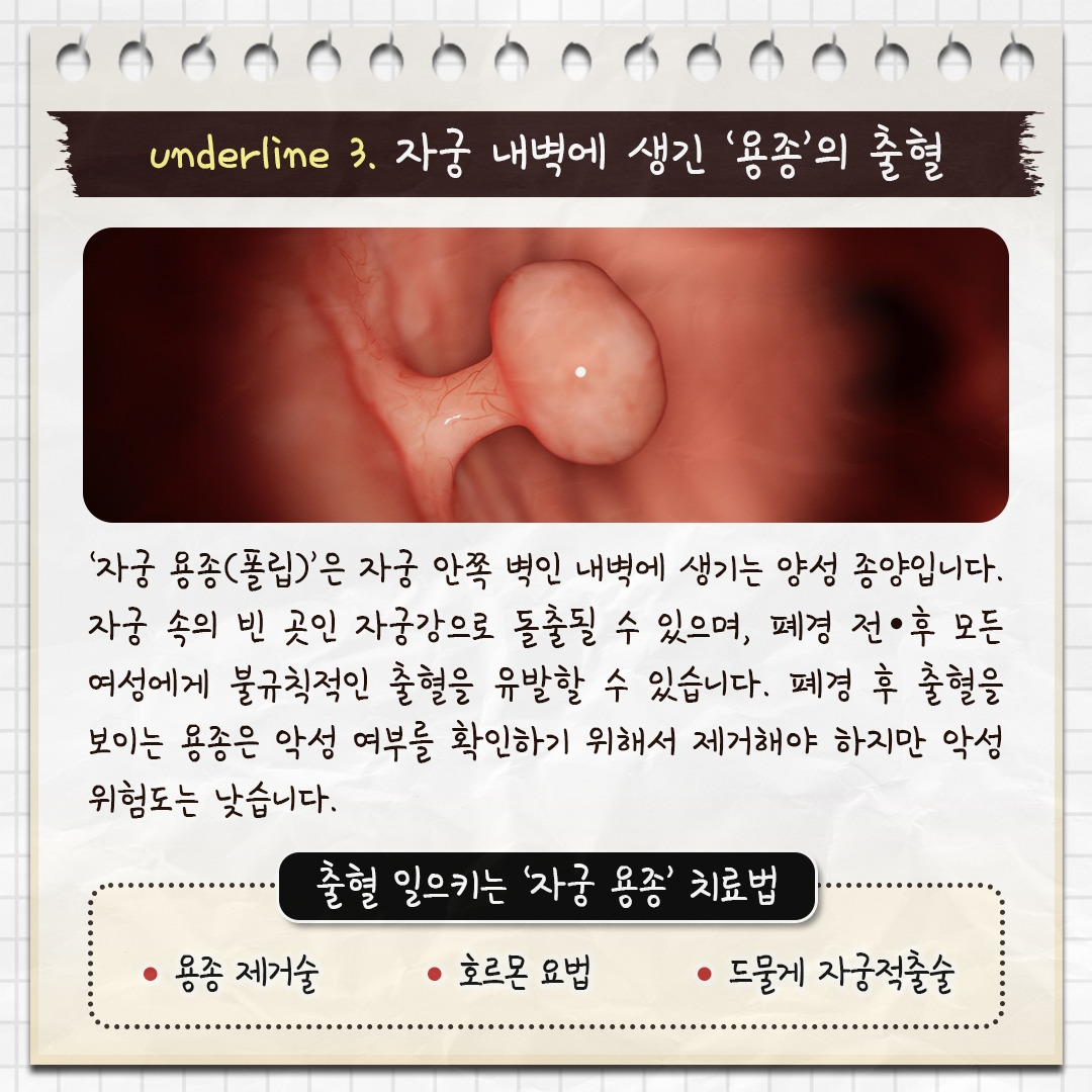 폐경후출혈_06.jpg