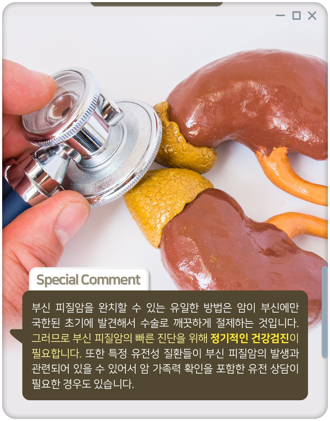 부신피질암_08.jpg