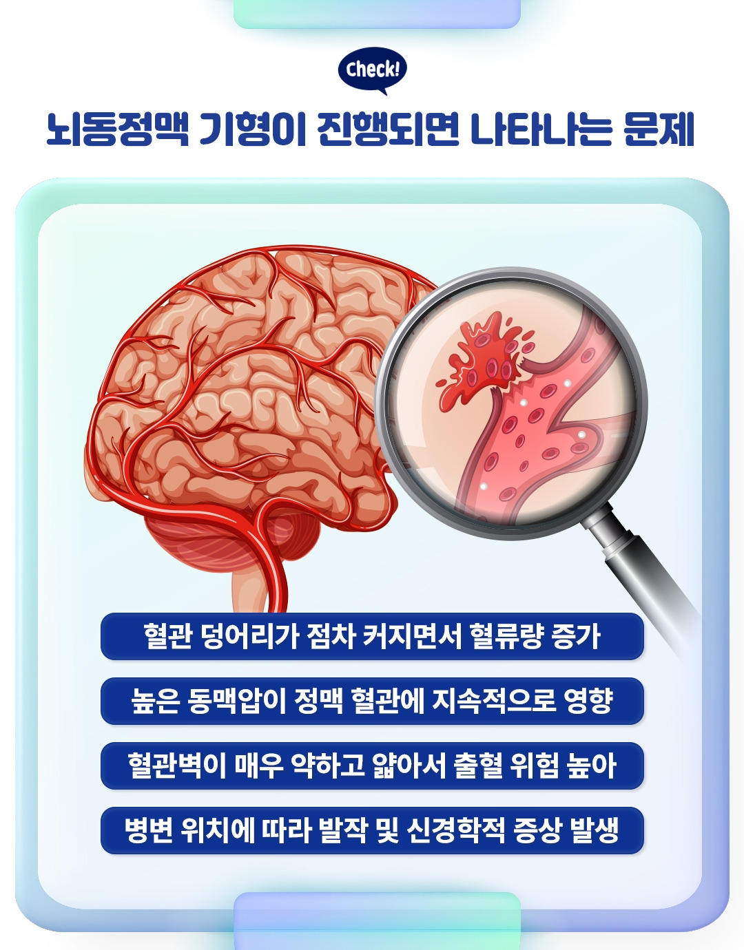 뇌동정맥 기형_05.jpg