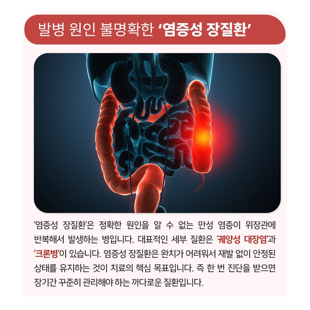 염증성장질환_02.jpg