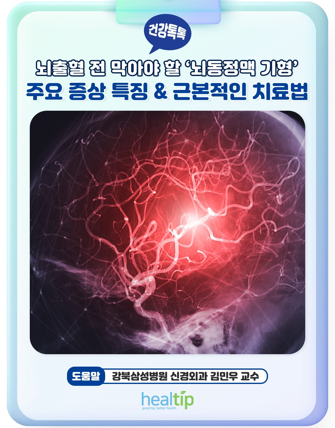 뇌동정맥 기형_01_힐팁.jpg