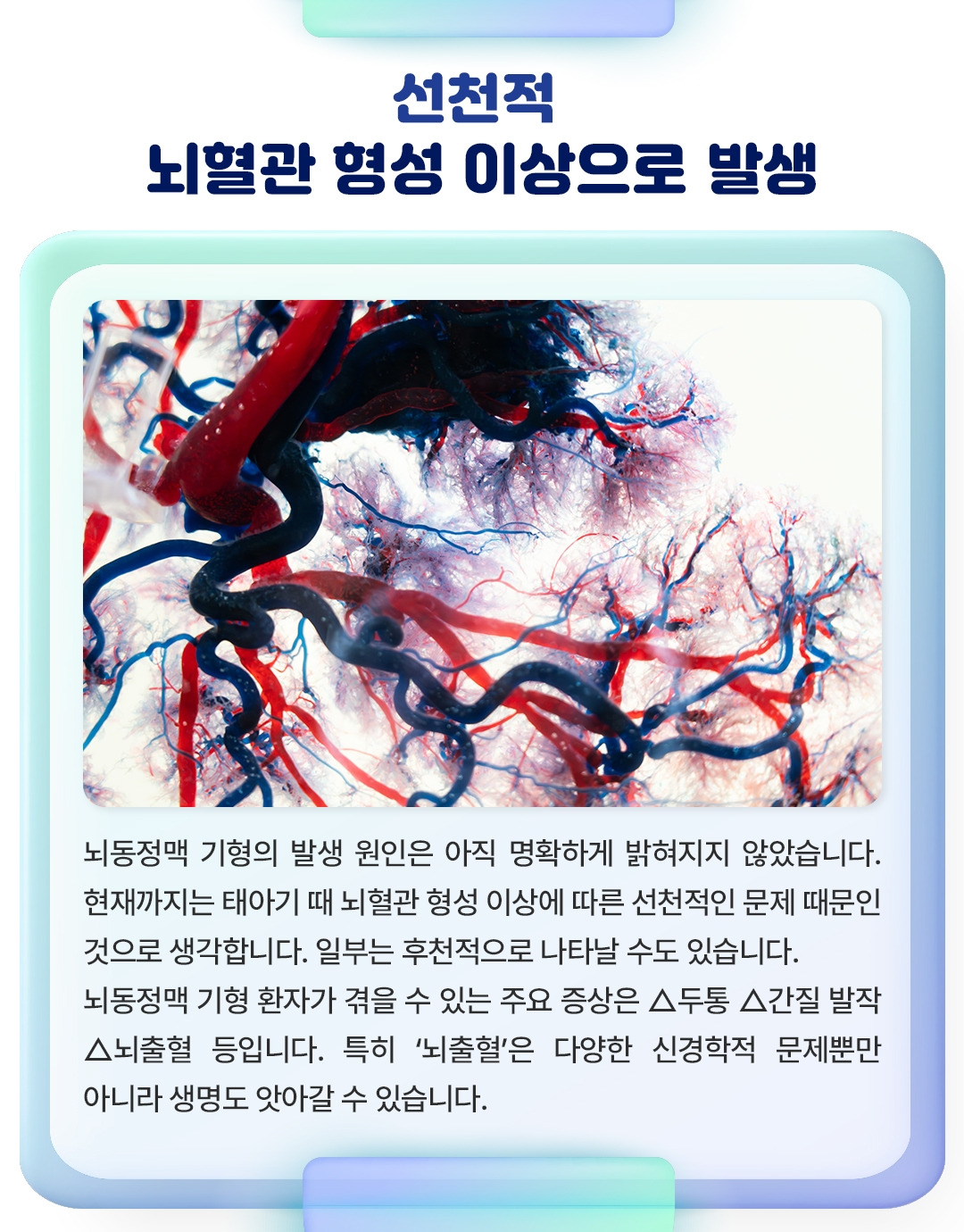 뇌동정맥 기형_03.jpg