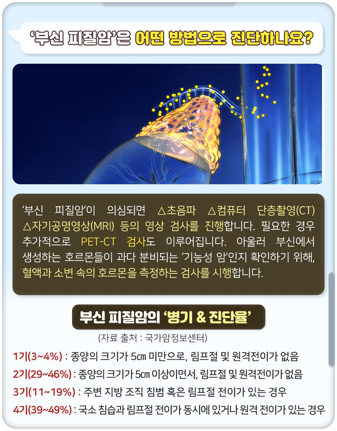 부신피질암_05.jpg