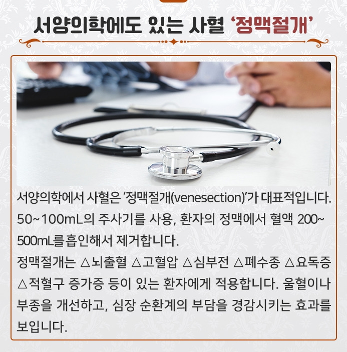 [한의학 궁금증 풀이 ㉟]피 빼는 ’사혈(瀉血)‘ 요법