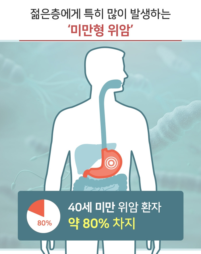 젊은 층에 많은 ‘미만형 위암’