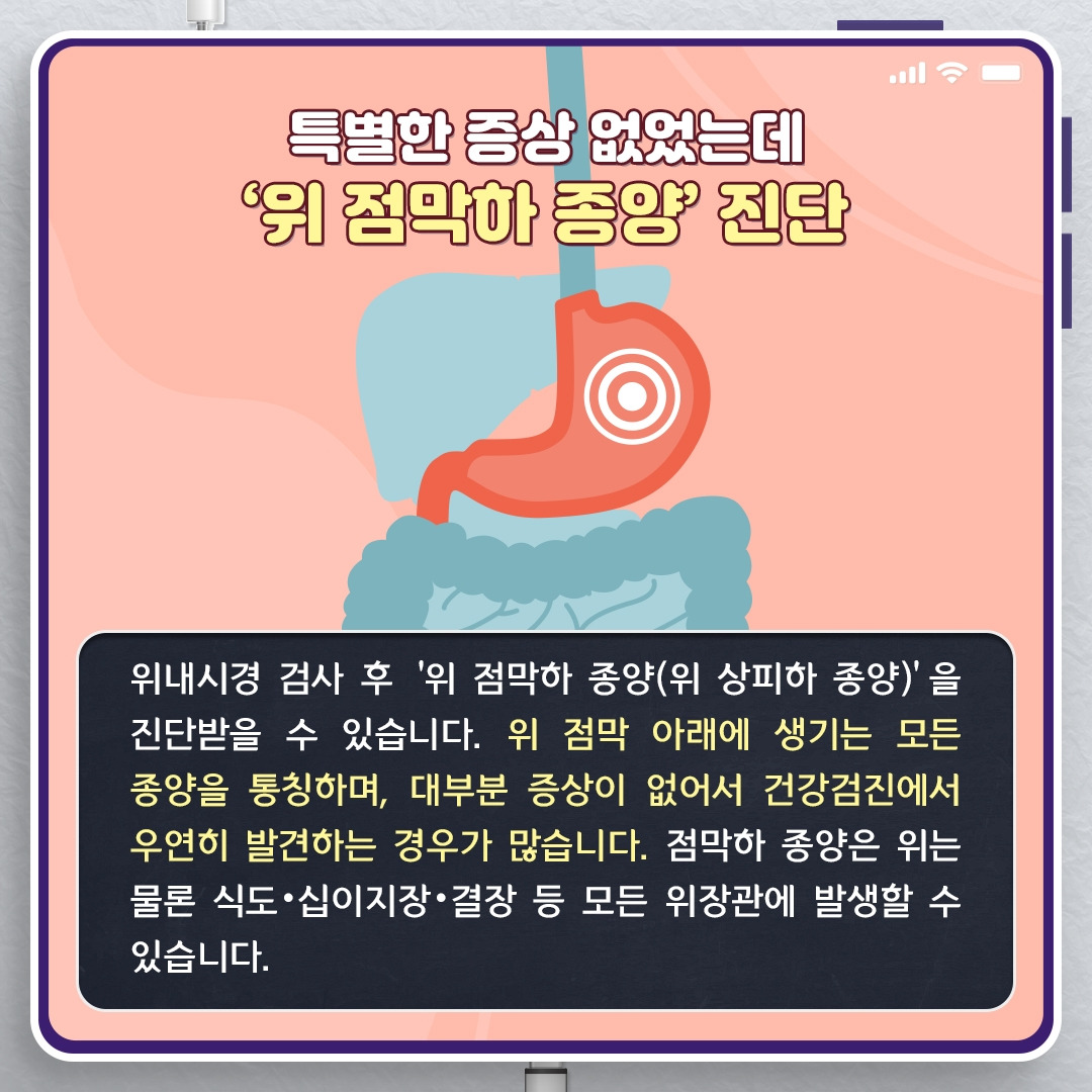 위내시경이 찾은 ‘위 점막하 종양’