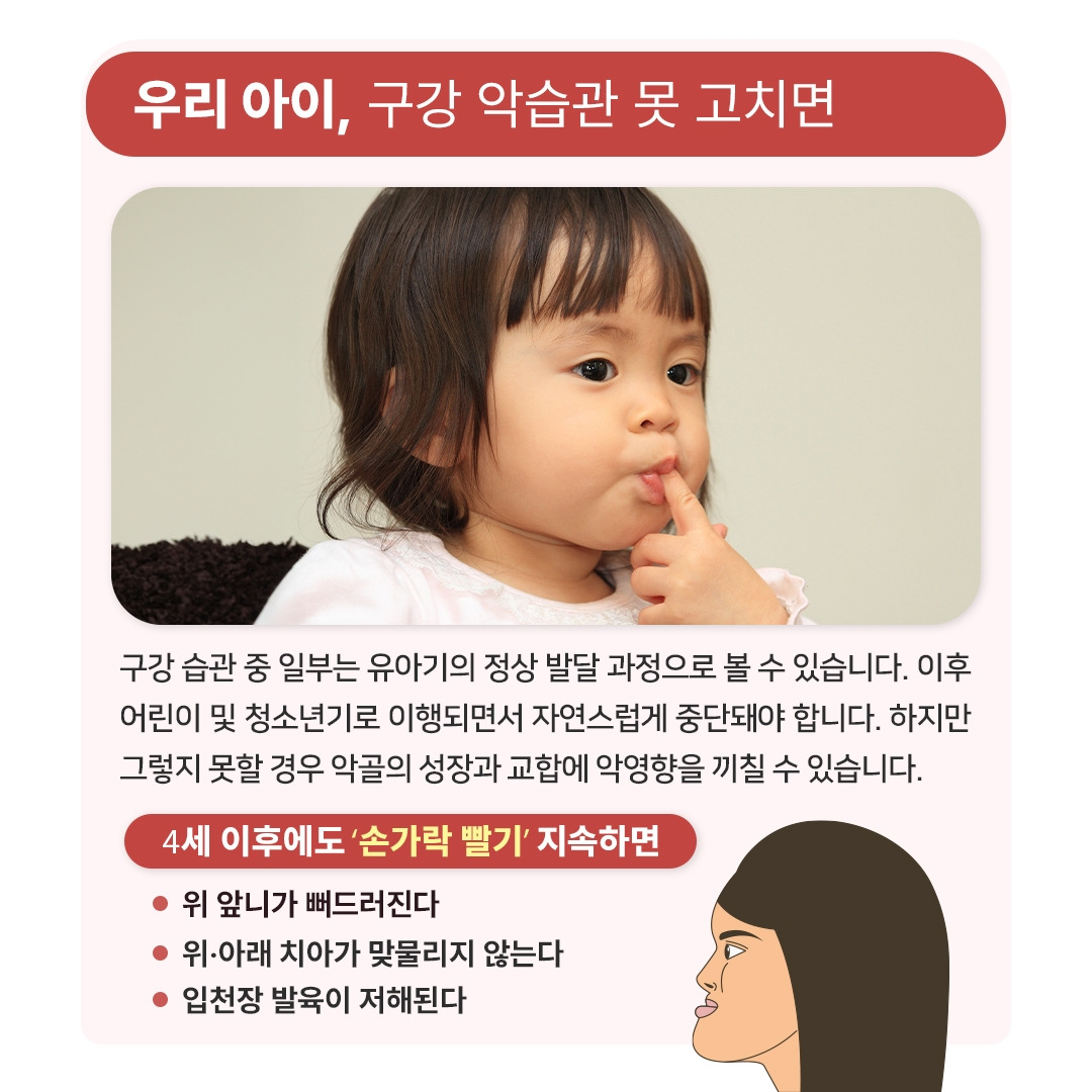 ‘부정교합’ 도화선 ‘나쁜 구강습관’