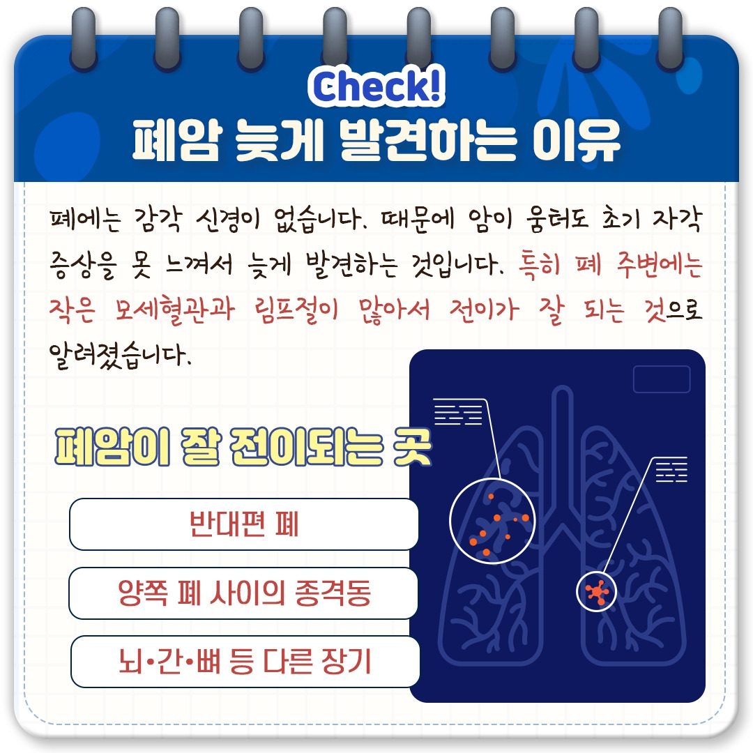 생존율 12% ‘원격 전이성 폐암’