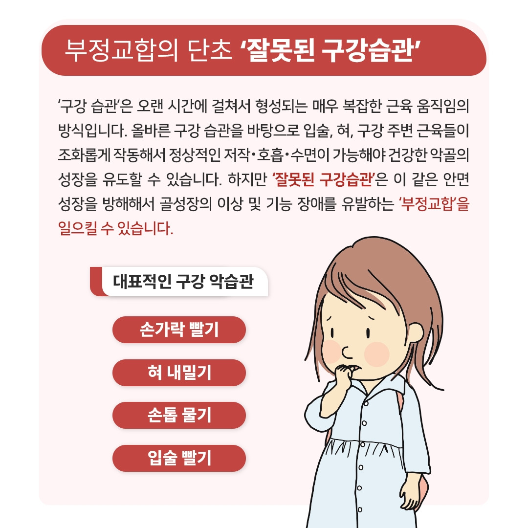 ‘부정교합’ 도화선 ‘나쁜 구강습관’