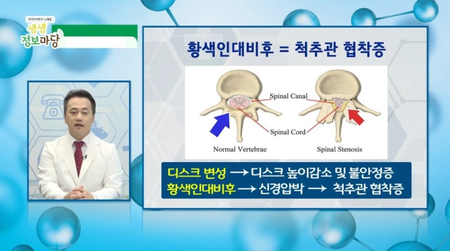 허리통증 치료 원인을 알아야