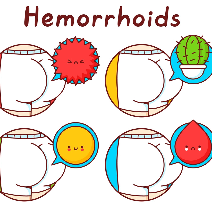 항문 밖으로 만져지는 치질, 혈전성외치핵 증상