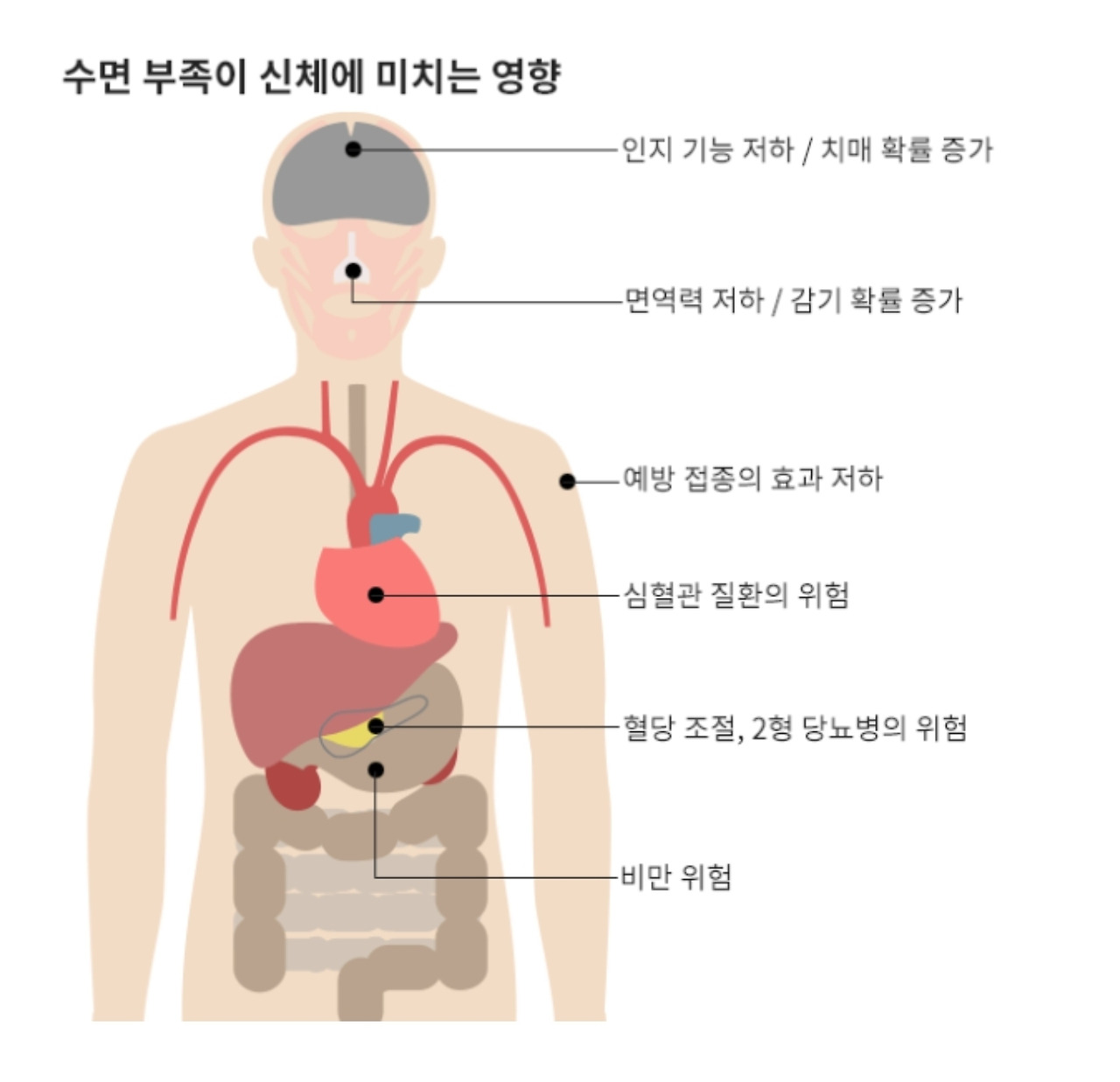 온라인 카지노 게임